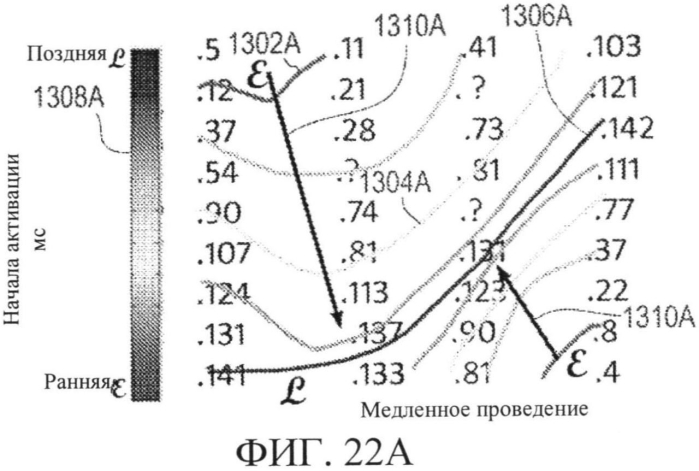 Способы, система и устройство для обнаружения, диагностики и лечения нарушений биологического ритма (патент 2556974)