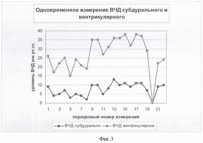 Способ определения причин внутричерепной гипертензии в остром периоде субарахноидального кровоизлияния после разрыва артериальных аневризм (патент 2372027)