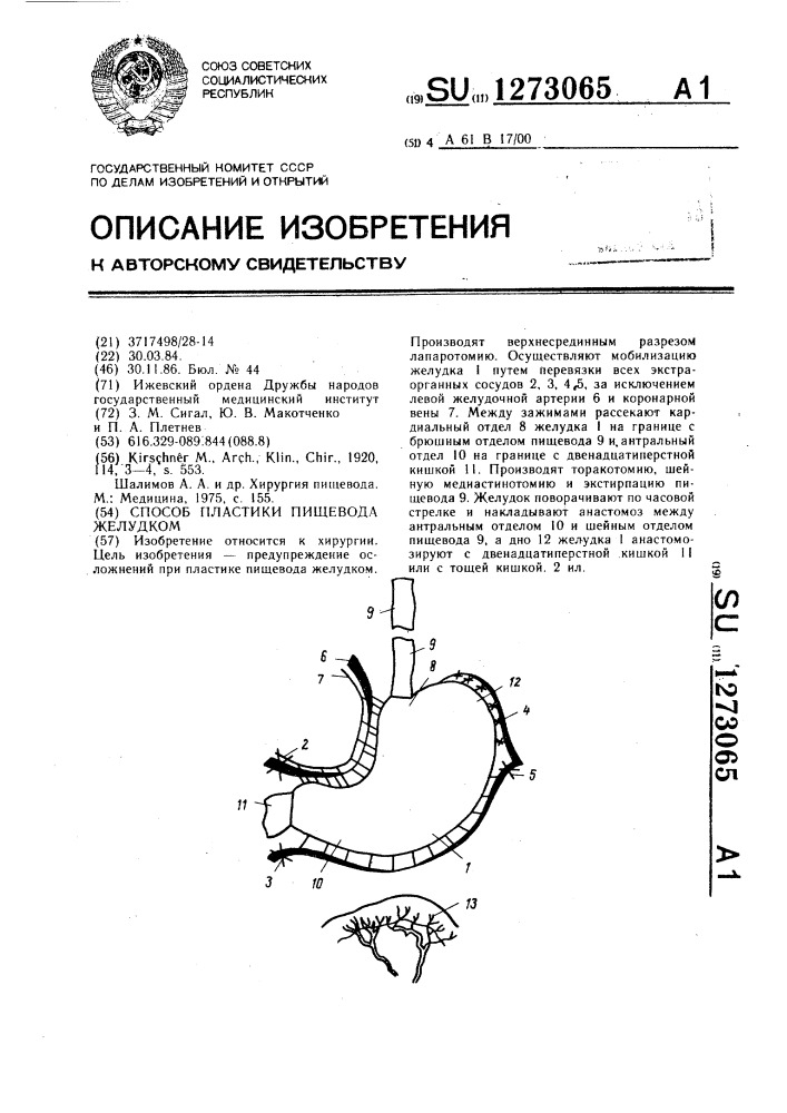 Способ пластики пищевода желудком (патент 1273065)