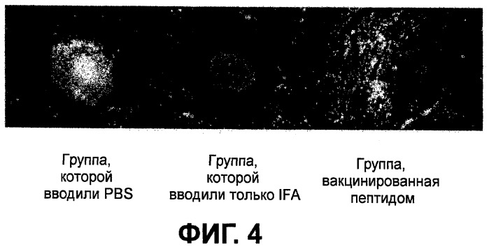 Вакцинотерапия неоваскуляризации сосудистой оболочки глаза (патент 2481118)