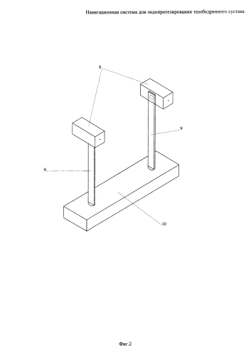 Навигационная система для эндопротезирования тазобедренного сустава (патент 2592129)