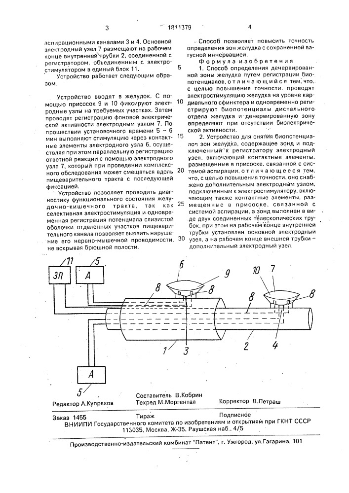 Способ определения денервированной зоны желудка и устройство для снятия биопотенциалов зон желудка (патент 1811379)