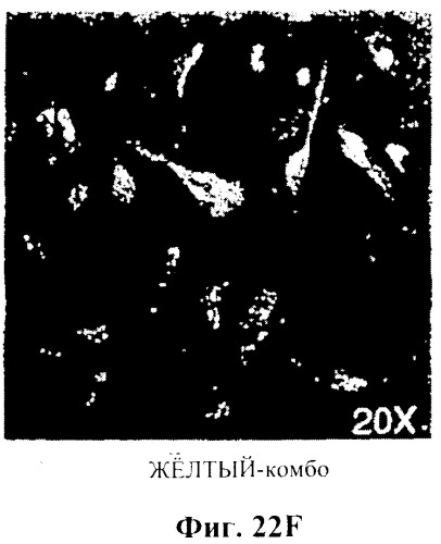 Захват эндотелиальных клеток-предшественников элюирующим лекарственные средства имплантируемым медицинским устройством (патент 2400256)