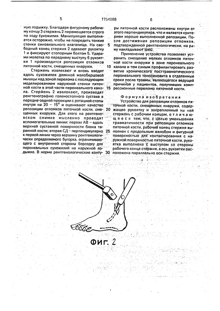 Устройство для репозиции отломков пяточной кости смещенных кнаружи (патент 1754088)