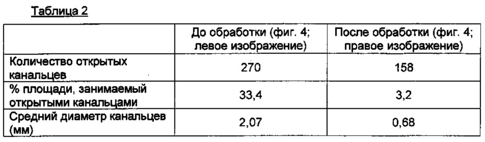 Обработка изображения канальцев дентина (патент 2635290)