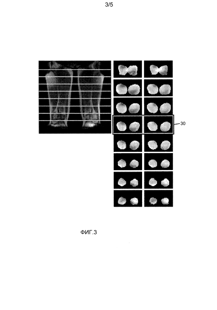 Магнитно-резонансная (mr) визуализация с в1-отображением (патент 2611082)