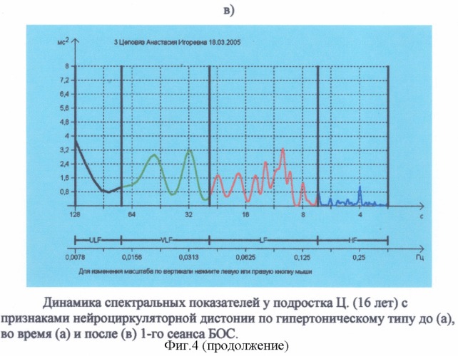 Способ коррекции вегетативных дисбалансов с помощью комплекса для обработки кардиоинтервалограмм и анализа вариабельности сердечного ритма &quot;варикард 2.51&quot;, работающего под управлением компьютерной программы iscim 6.1 (build 2.8), c использованием биологической обратной связи (патент 2317771)