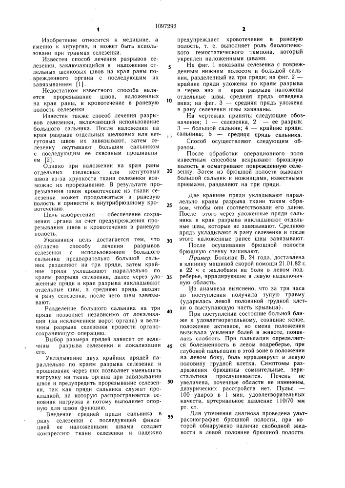 Способ лечения разрывов селезенки (патент 1097292)