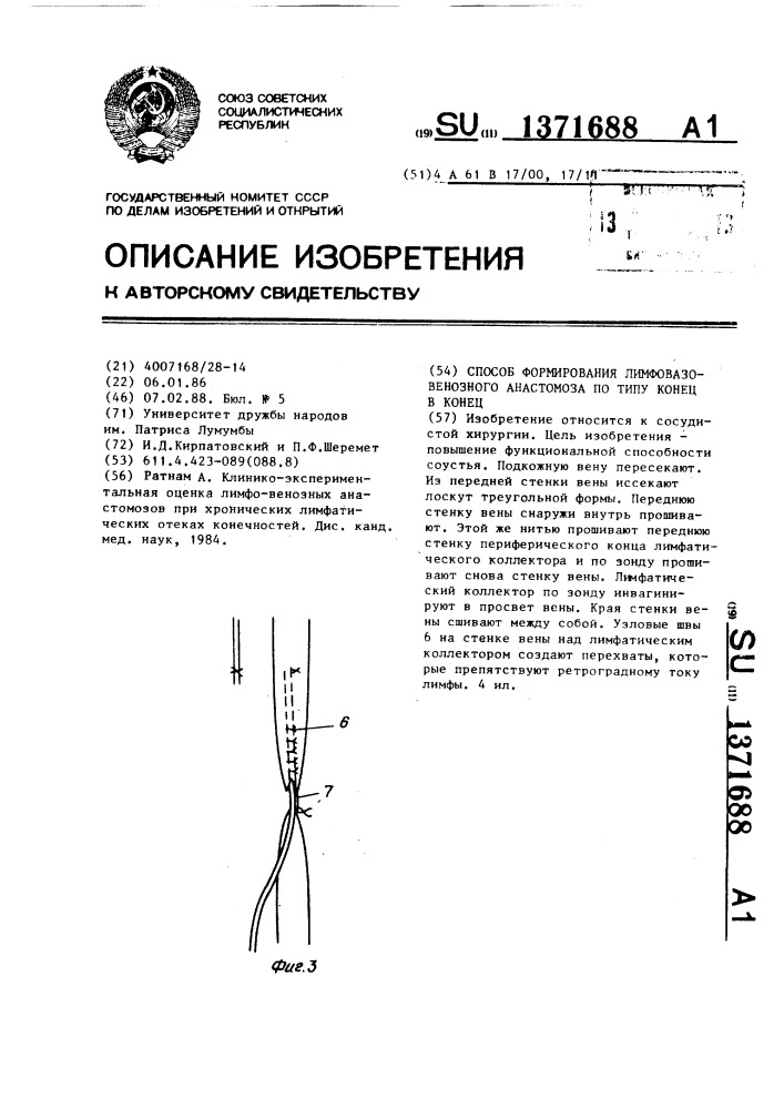 Способ формирования лимфовазовенозного анастомоза по типу конец в конец (патент 1371688)