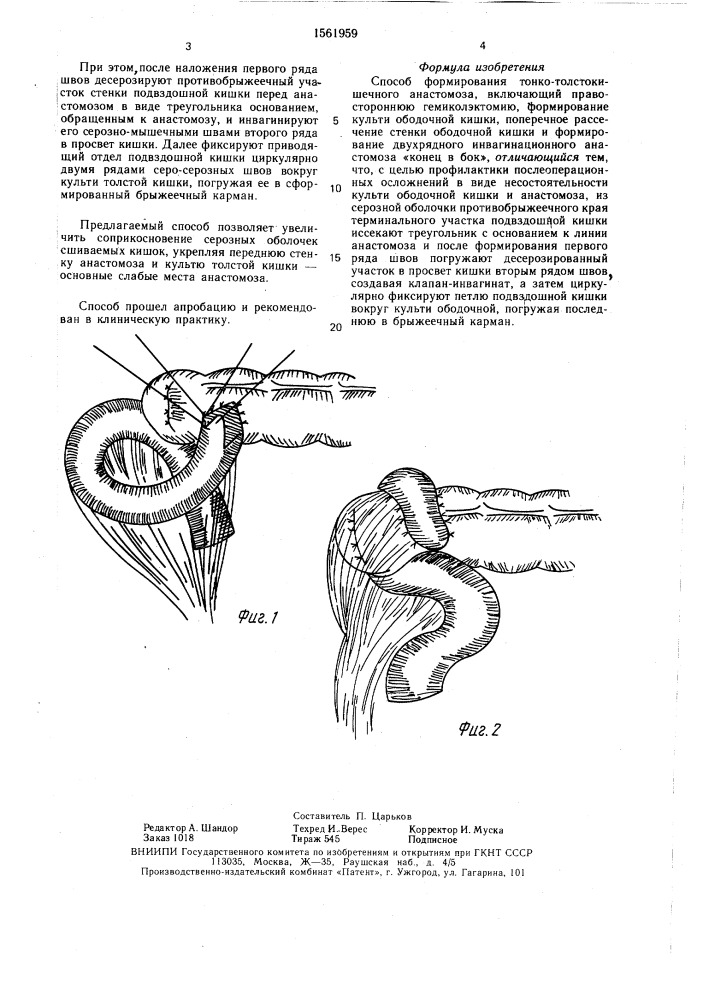 Способ формирования тонко-толстокишечного анастомоза (патент 1561959)