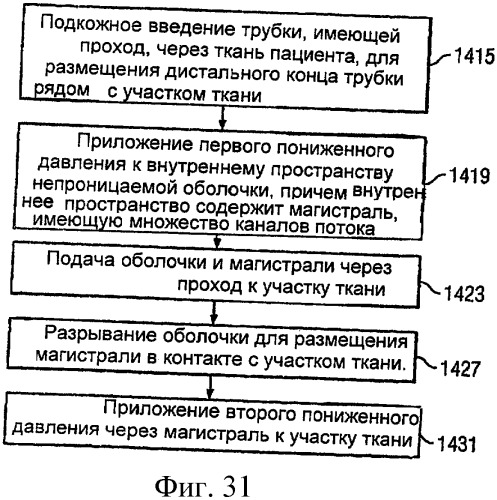 Система и способ продувки устройства пониженного давления во время лечения путем подачи пониженного давления (патент 2404822)