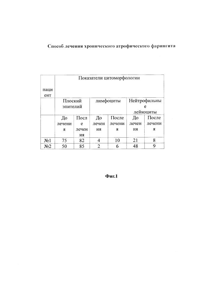 Способ лечения хронического атрофического фарингита (патент 2613186)