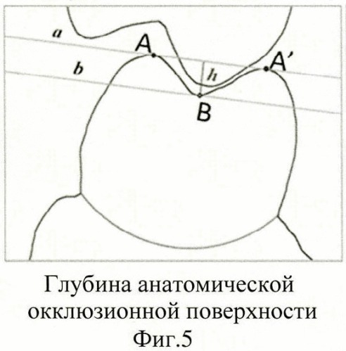 Способ измерения размеров зубов, зубных бугров и их внутренних и наружных скатов (патент 2438617)