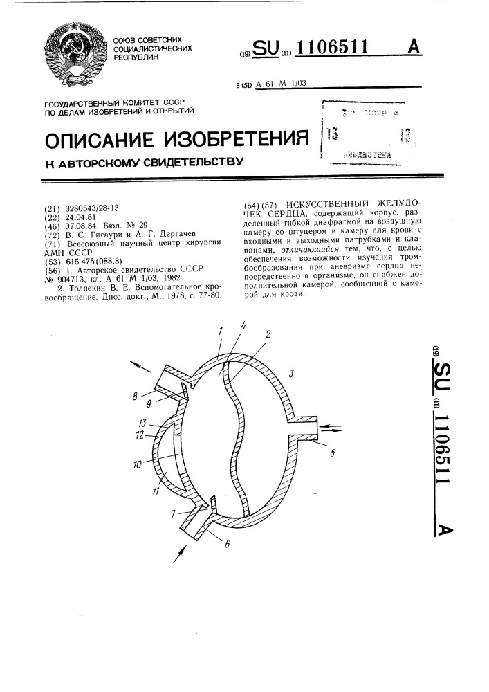 Искусственный желудочек сердца (патент 1106511)