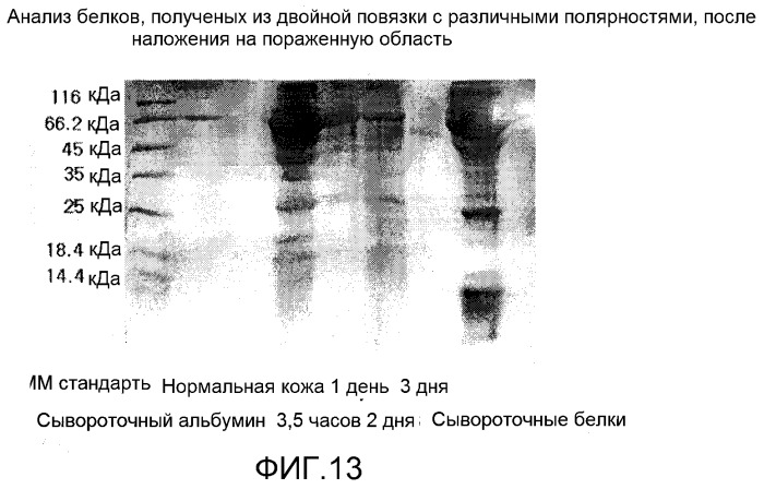 Повязка для лечения кожных заболеваний и облегчения симптомов кожных болезней, вызывающих экссудацию белков крови (патент 2524628)