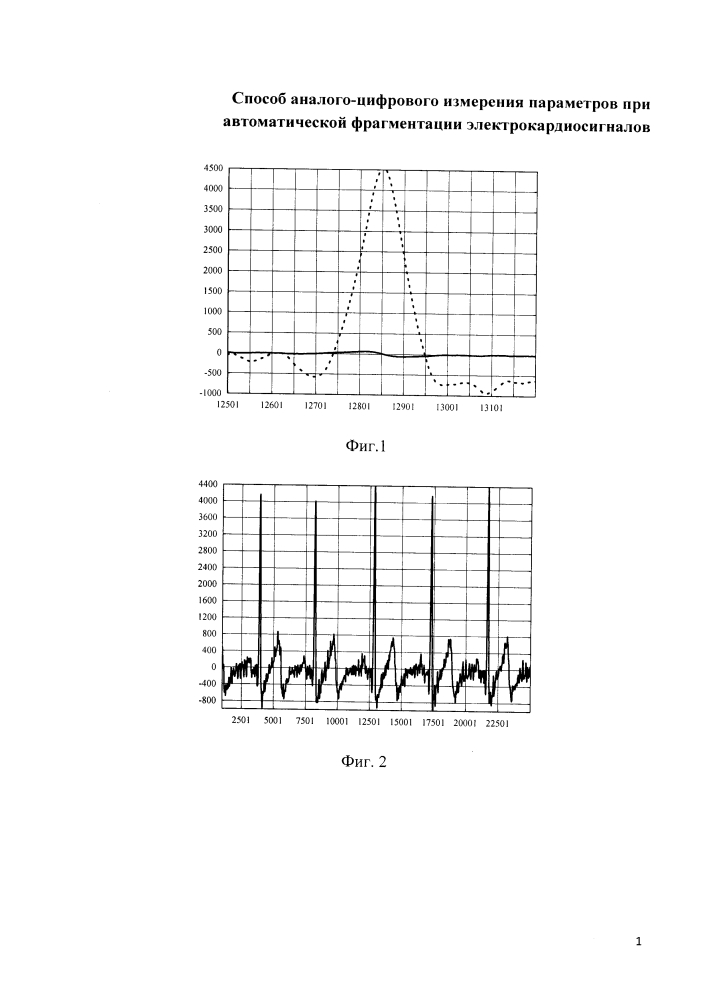 Способ аналого-цифрового измерения параметров при автоматической фрагментации электрокардиосигналов (патент 2636905)