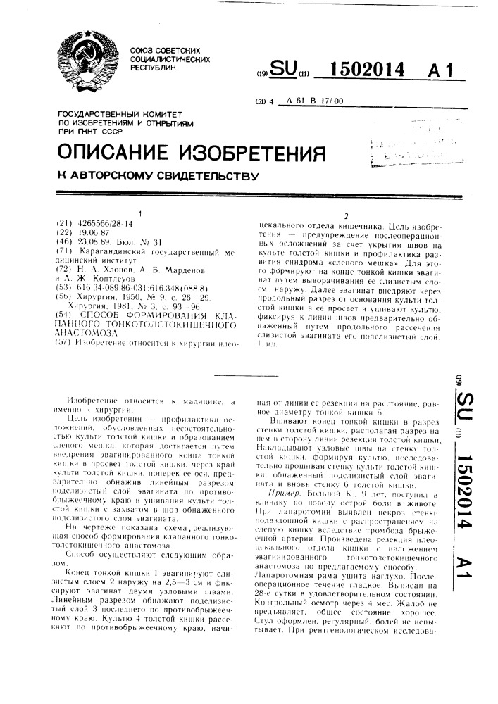 Способ формирования клапанного тонкотолстокишечного анастомоза (патент 1502014)