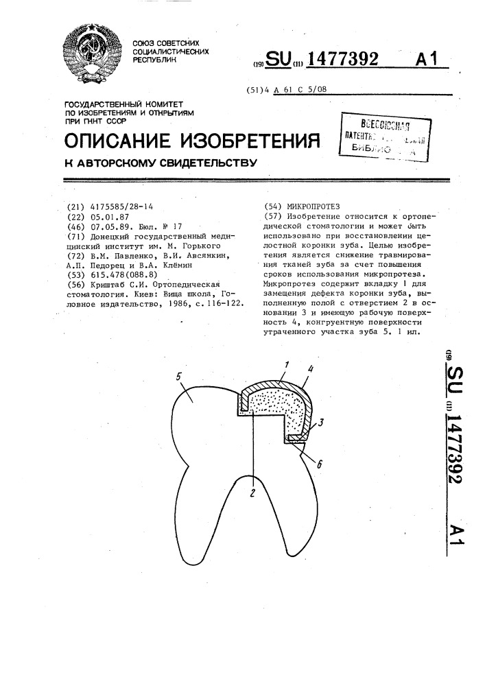Микропротез (патент 1477392)