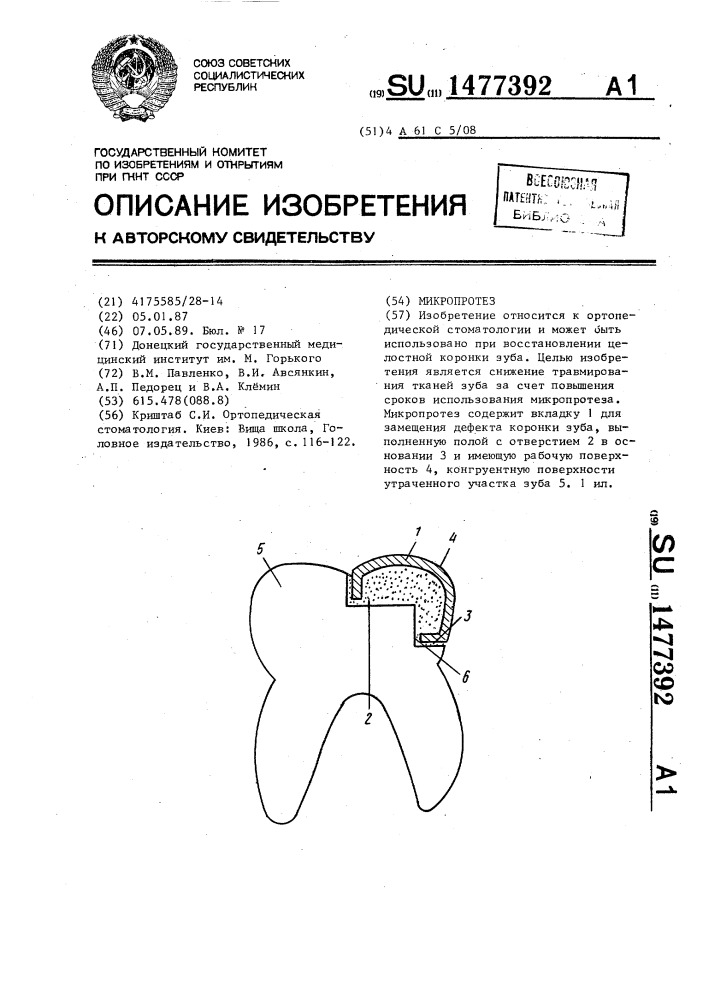 Микропротез (патент 1477392)