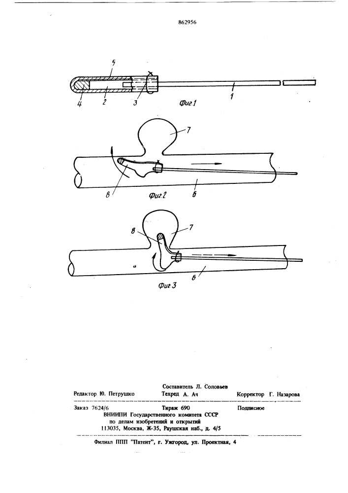 Окклюзирующее устройство (патент 862956)