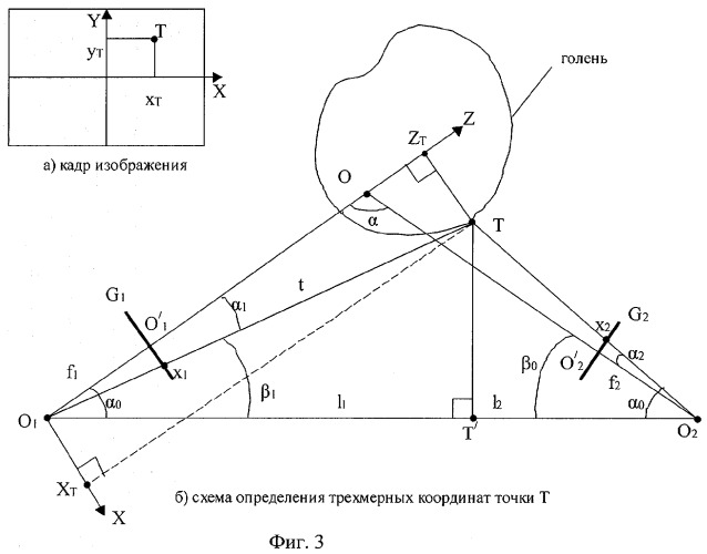 Способ оптико-электронной диагностики тромбоза глубоких вен голени (патент 2314026)