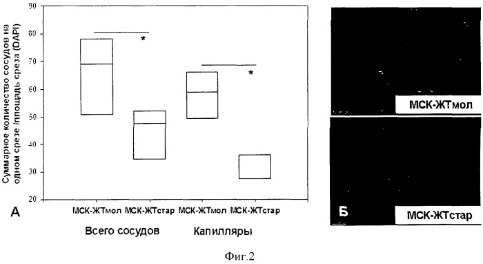 Способ оценки ангиогенного потенциала прогениторных клеток у больных сердечно-сосудистыми заболеваниями (патент 2548801)