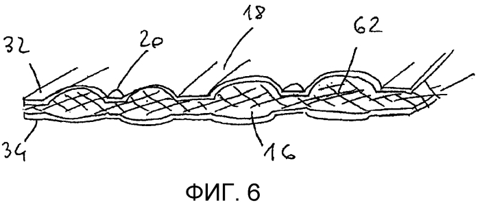 Устойчивая к перекрытию и/или многослойная лечебная накладка (патент 2557047)