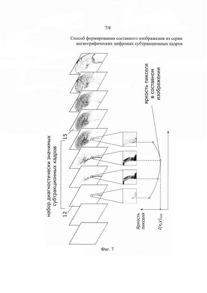 Способ формирования составного изображения из серии ангиографических цифровых субтракционных кадров (патент 2633949)