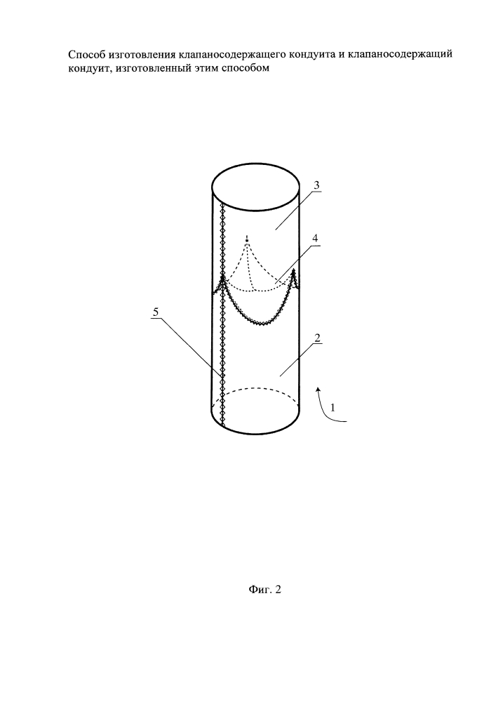 Способ изготовления клапаносодержащего кондуита и клапаносодержащий кондуит, изготовленный этим способом (патент 2644287)