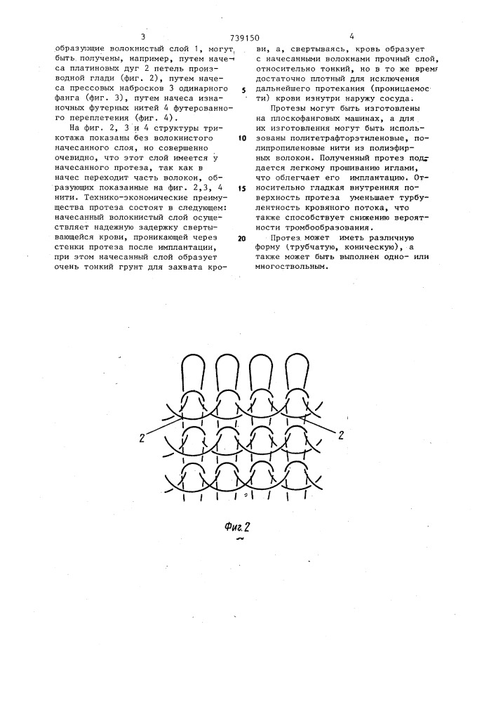 Протез кровеносного сосуда с ворсовой поверхностью (патент 739150)