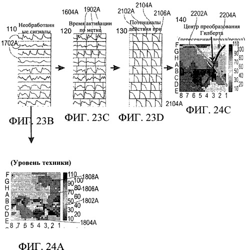 Способы, система и устройство для обнаружения, диагностики и лечения нарушений биологического ритма (патент 2559639)