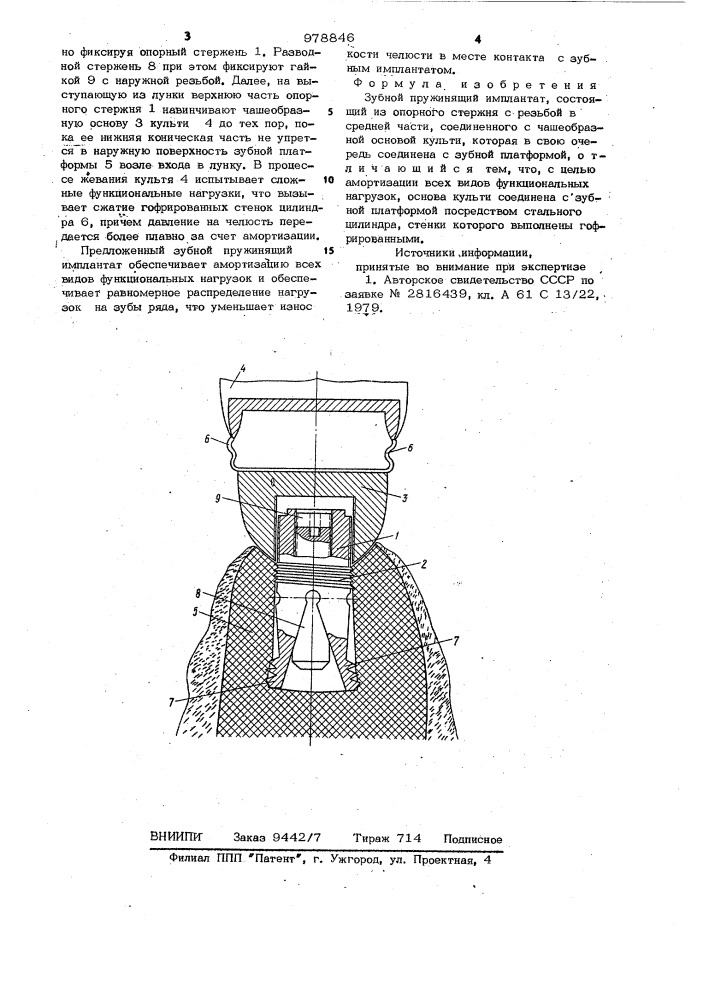 Зубной пружинящий имплантат (патент 978846)