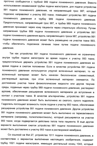 Система и способ продувки устройства пониженного давления во время лечения путем подачи пониженного давления (патент 2404822)