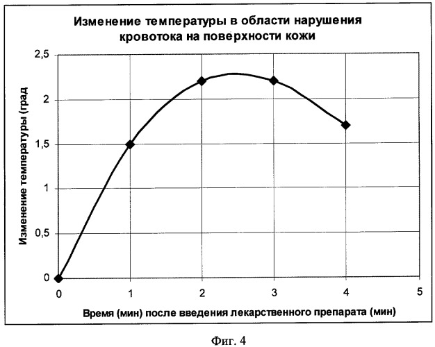 Способ диагностики сосудистой патологии путем активного термолокационного зондирования (патент 2428102)