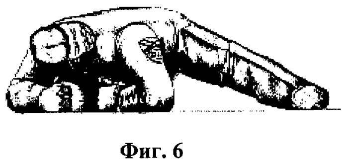 Способ укрепления здоровья человека (варианты) (патент 2264799)