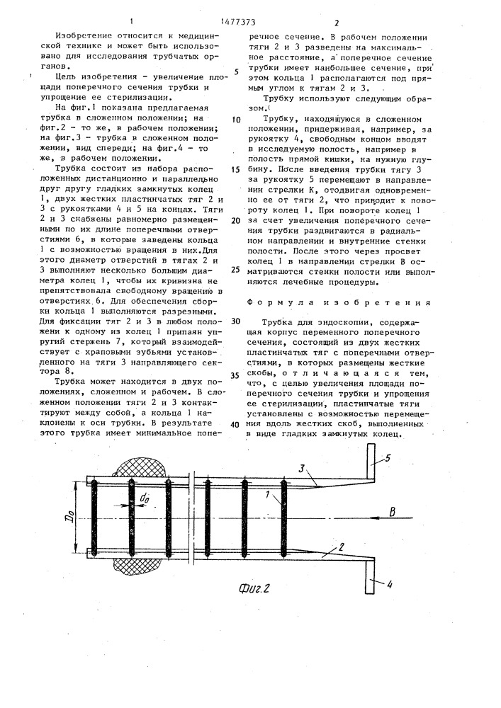 Трубка для эндоскопии (патент 1477373)