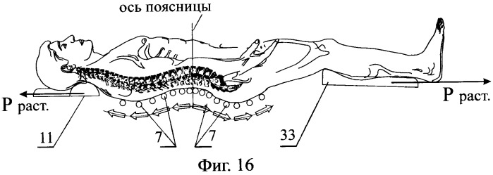 Устройство для коррекции и лечения позвоночника (патент 2250097)