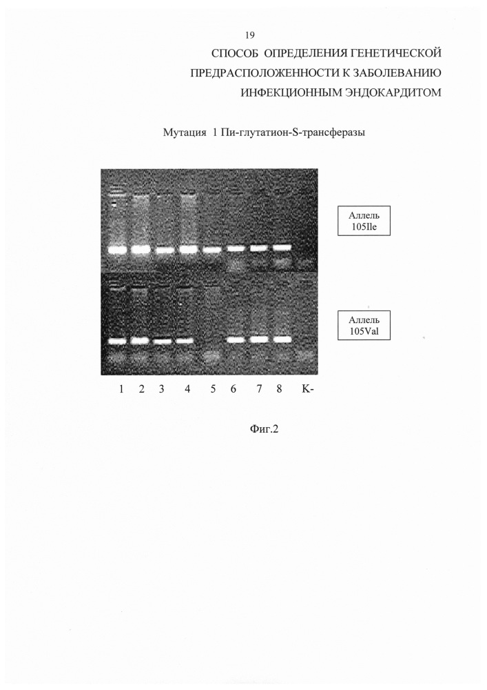 Способ определения генетической предрасположенности к заболеванию инфекционным эндокардитом (патент 2618459)