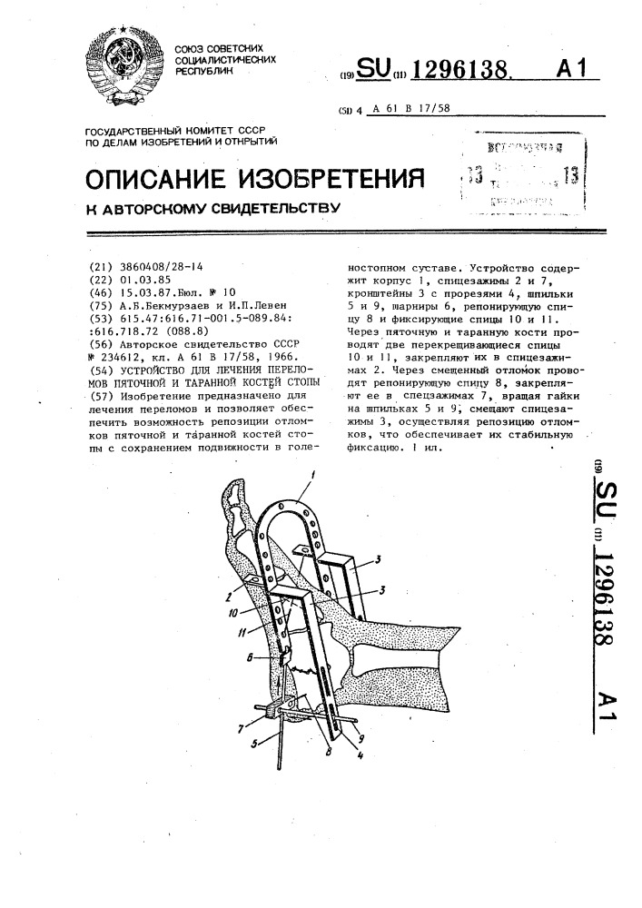 Витафон при пяточной шпоре схема лечения