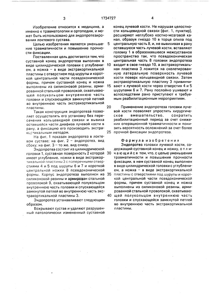 Эндопротез головки лучевой кости (патент 1734727)