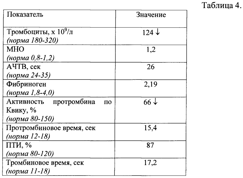 Способ определения риска развития гиперкоагуляции у больных с портальной гипертензией цирротического генеза после проведения портосистемного шунтирования (патент 2665118)