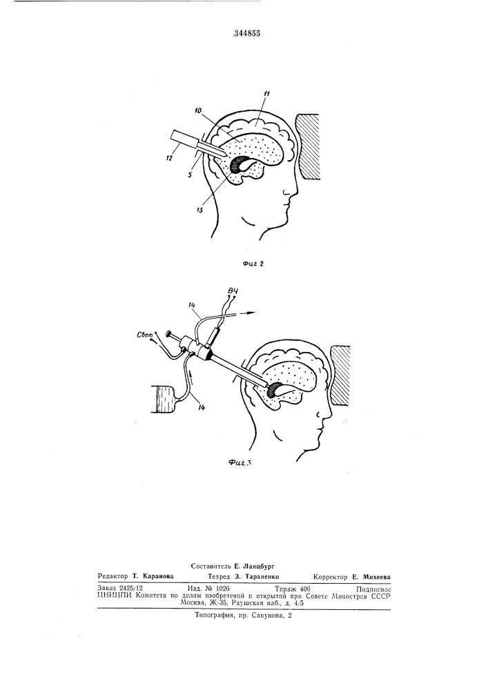 Вентрикулоскоп с устройством для (патент 344855)