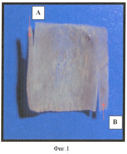 Способ фиксации тимпанального лоскута при тимпанопластике (патент 2332193)