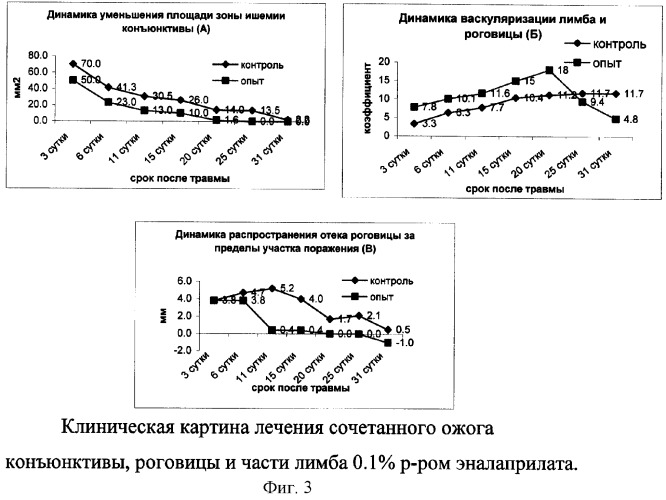 Способ лечения и профилактики глазных болезней, связанных с ишемией тканей глаза (патент 2268722)