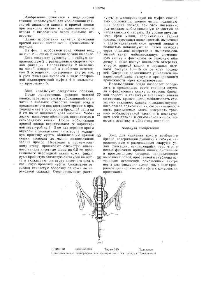 Зонд для удаления полого трубчатого органа (патент 1355261)