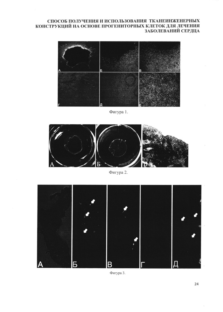 Способ получения и использования тканеинженерных конструкций на основе прогениторных клеток для лечения заболеваний сердца (патент 2636464)