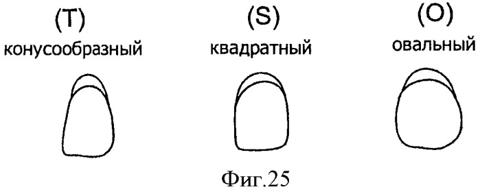 Зубные протезы, зубные дуги и способы их изготовления (патент 2510252)