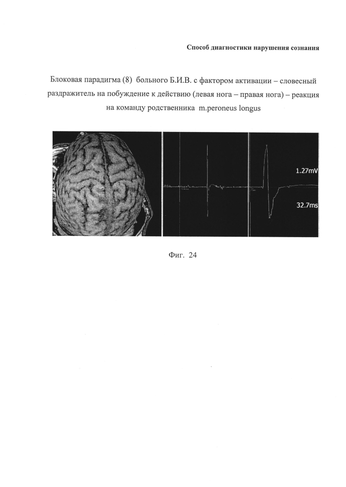 Способ диагностики нарушения сознания (патент 2596049)