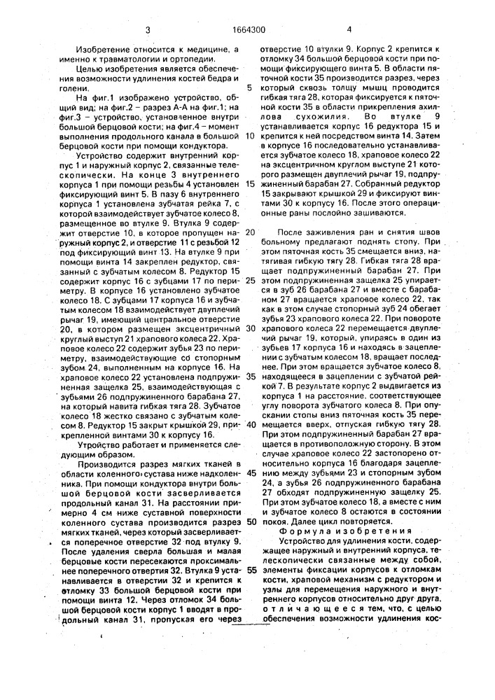 Устройство для удаления кости (патент 1664300)