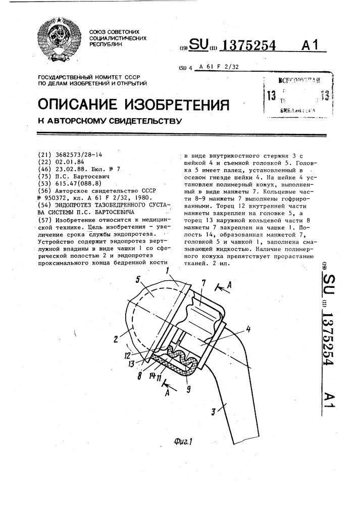 Эндопротез тазобедренного сустава системы п.с.бартосевича (патент 1375254)